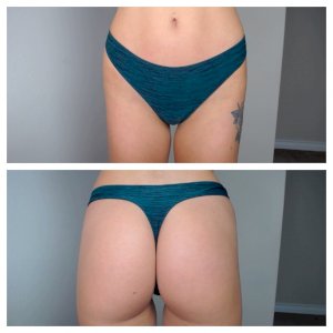 Green Stripped Aerie Thong ♡
